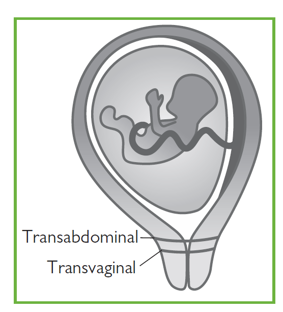 Cervical Cerclage - cerclage : 1. provide structural support to a „weak‟  cervix, 2. maintain - Studocu